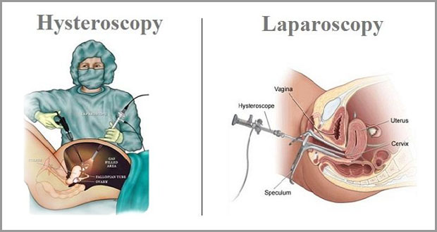 Laparoscopy and Hysteroscopy by Dr. Shilpa Dhameja, Gynecological Surgeon Vasant Kunj